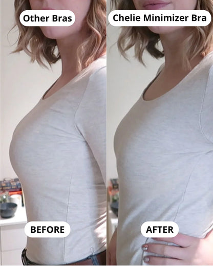 Breast Minimizer Bra - Orynel™