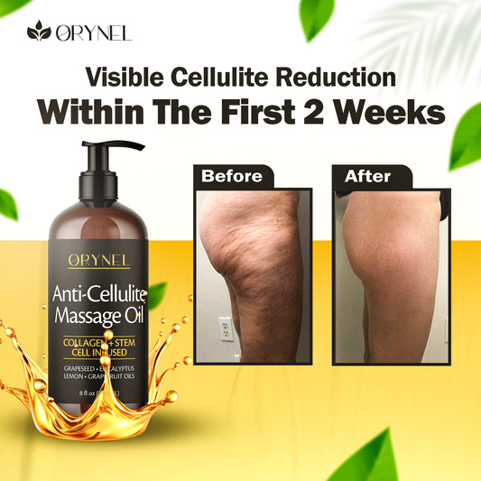 Orynel™ Cellulite Oil